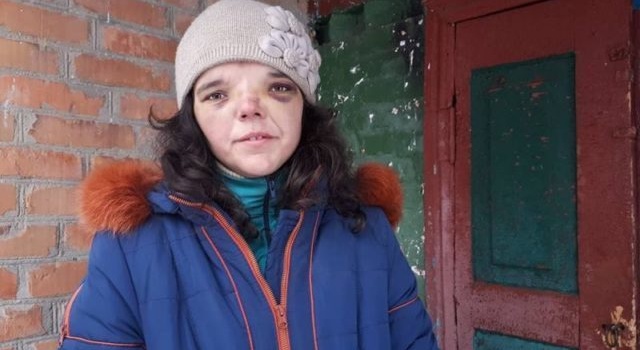 Избиение ребенка на Винниччине: мачеха исчезла без следа