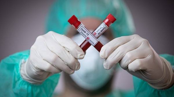 Эксперты пояснили, почему у мужчин и пожилых людей более тяжелое проявление коронавируса Эксперты пояснили, почему у мужчин и пожилых людей более тяжелое проявление коронавируса
